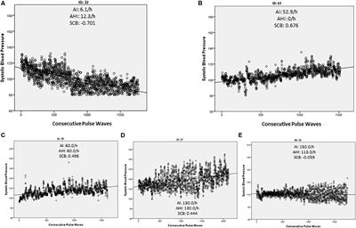 The Importance of Sleep Fragmentation on the Hemodynamic Dipping in Obstructive Sleep Apnea Patients